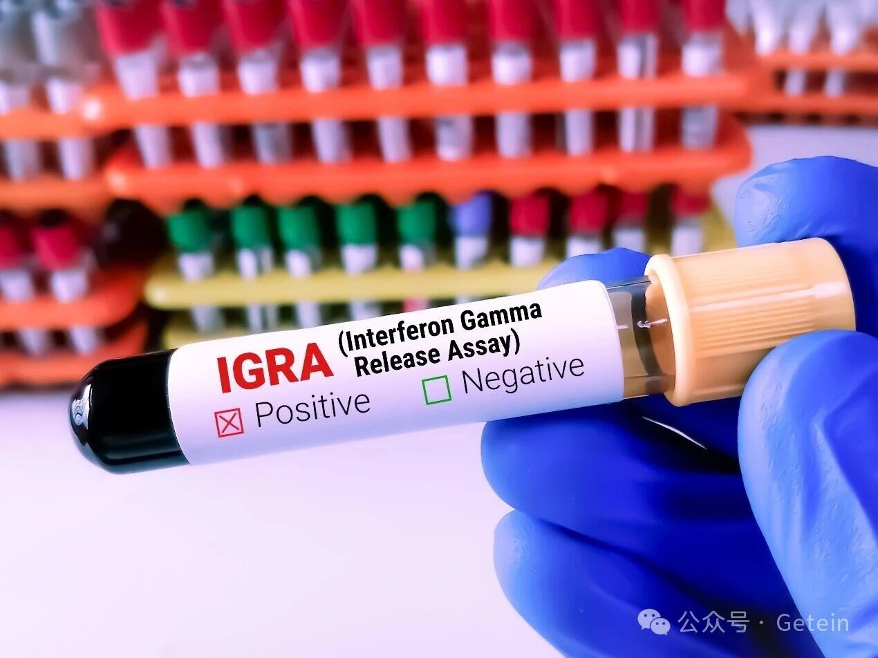 Solução Abrangente e Precisa para Testes TB-IGRA